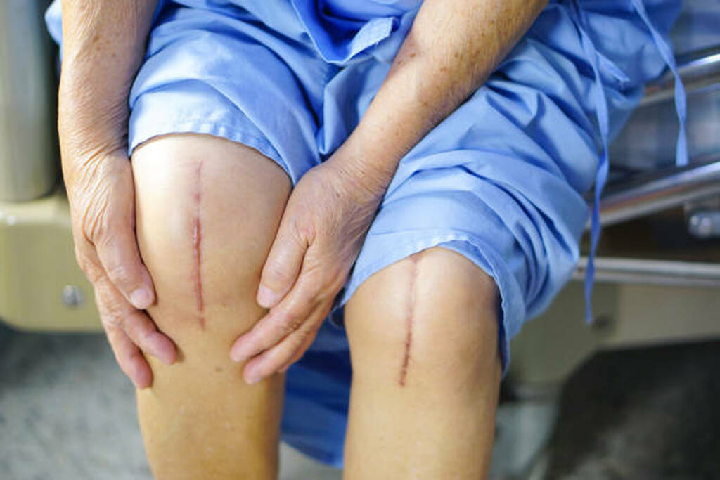 Best joint replacement hospital in Panavel